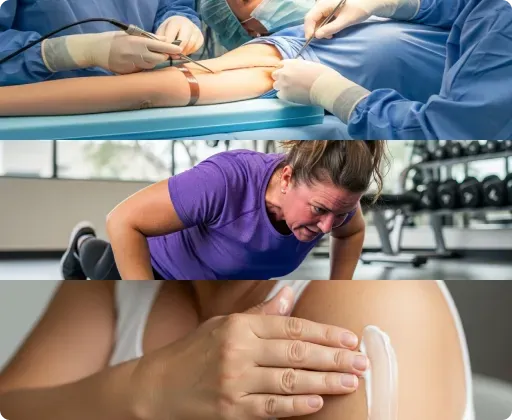 Arm lift surgery, arm workouts at the gym and firming cream on the arm